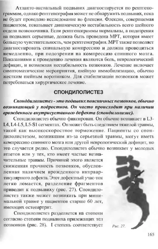  Коллектив авторов - Боль в спине - Страница № 166