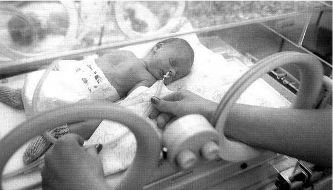 Ребенок родился в 6 месяцев. Самый недоношенный ребенок. Семимесячные дети недоношенные. Килограммовые дети недоношенных. Недоношенный ребёнок 1500гр.